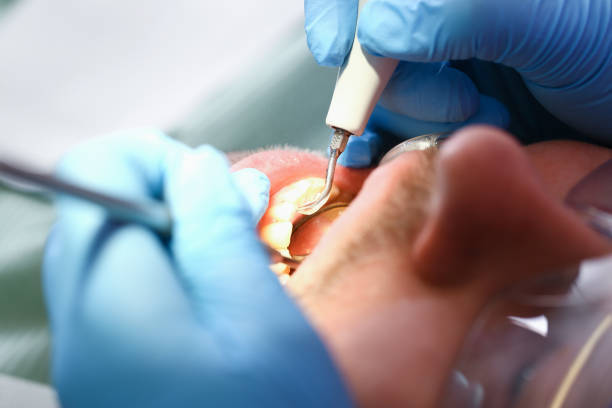 Best Emergency Treatment for Jaw Pain or Injury in Abaster, AL